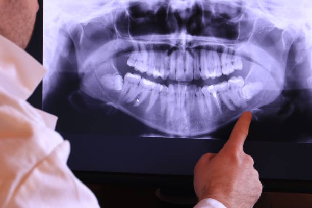 Best Chipped Tooth Repair Near Me  in Mitchell, NE
