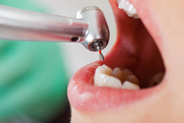 Best Emergency Dental Clinic in NE